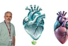 Kalp Ameliyatı oldunuz, Peki ya sonrası? Yara bakımında dikkat edilmesi gerekenler 23