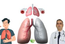 "Yaşlandım Artık" demeyin! KOAH'ın ilk sinyalleri yaşlanmayla karıştırılıyor 7