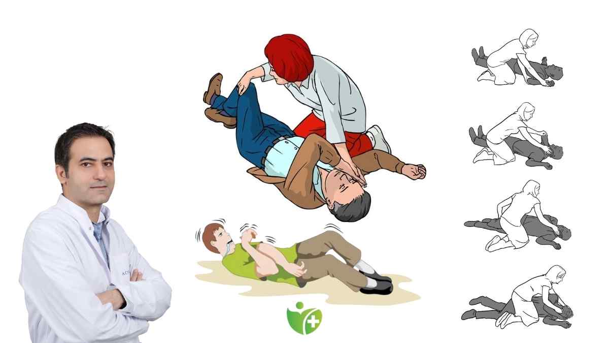 Epilepsi nöbetinde zaman beyindir! Her saniyenin önemi var 7