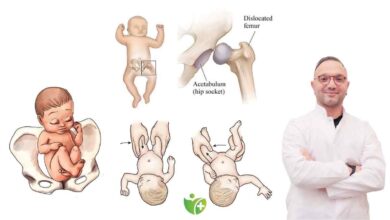 Doğuştan Kalça çıkığı sessizce ilerliyor! Erken teşhis için tarama şart 3