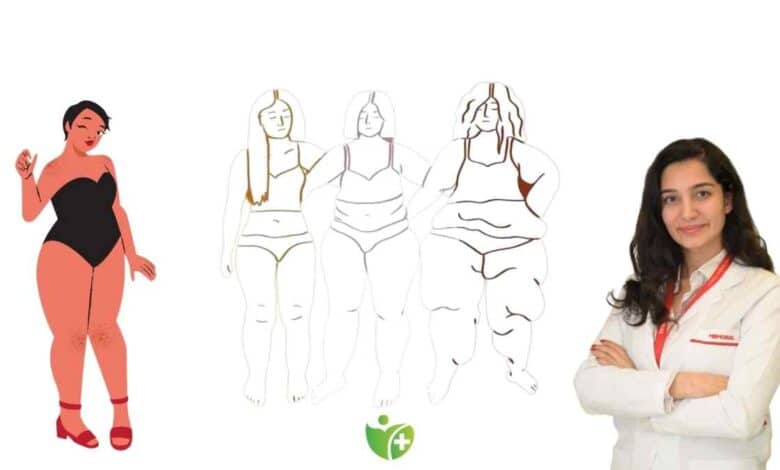 Lipödem nedir? Ve onunla nasıl yaşanır? İşte 7 kritik tavsiye 1