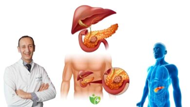 Pankreas Kanserinde yeni umut: Devrim niteliğinde tedaviler gündemde! 3