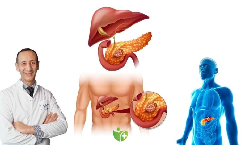 Pankreas Kanserinde yeni umut: Devrim niteliğinde tedaviler gündemde! 1