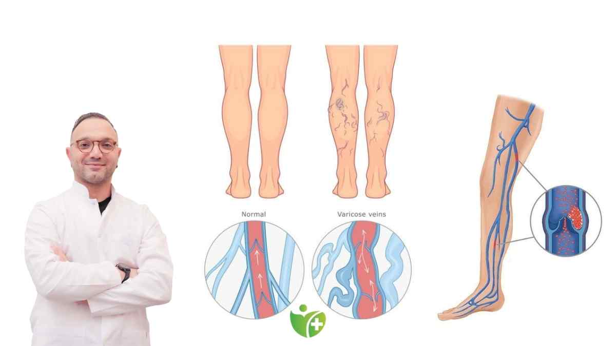 Varis hafife alınmamalı! İlerlediğinde ciddi komplikasyonlara yol açabilir 7
