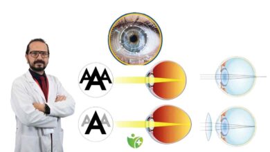 Dijital Ekranlar çocukların gözünü bozuyor: Miyopi hızla yayılıyor 5