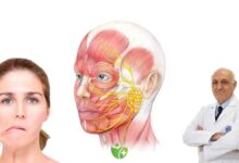 Rüzgar ve Soğuk yüz felcine neden olabilir mi? Gerçekler ve efsaneler 32