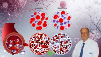 Çocukluk çağı kanserlerinde en büyük pay löseminin 1