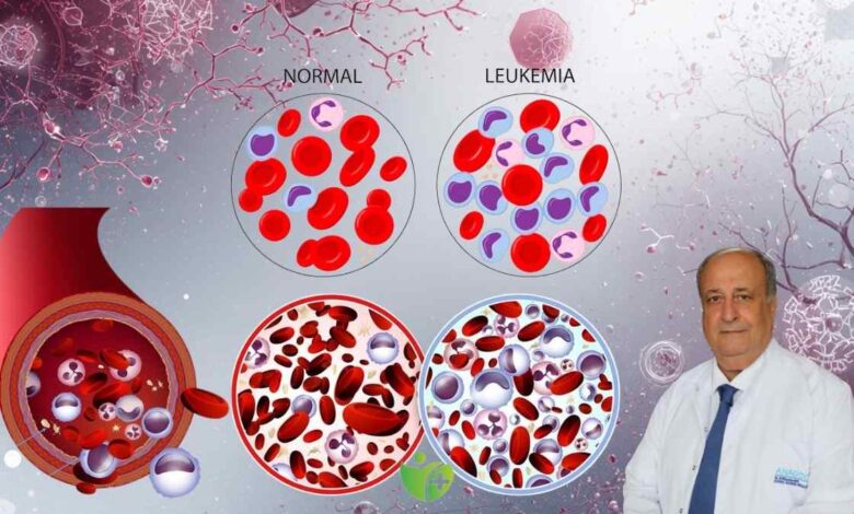 Çocukluk çağı kanserlerinde en büyük pay löseminin 1