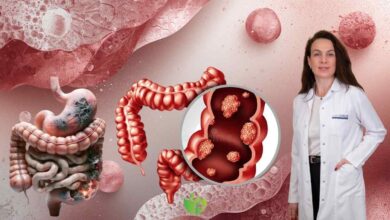 Kolon Kanseri riskini azaltmak için değiştirmeniz gereken 3 alışkanlık 3