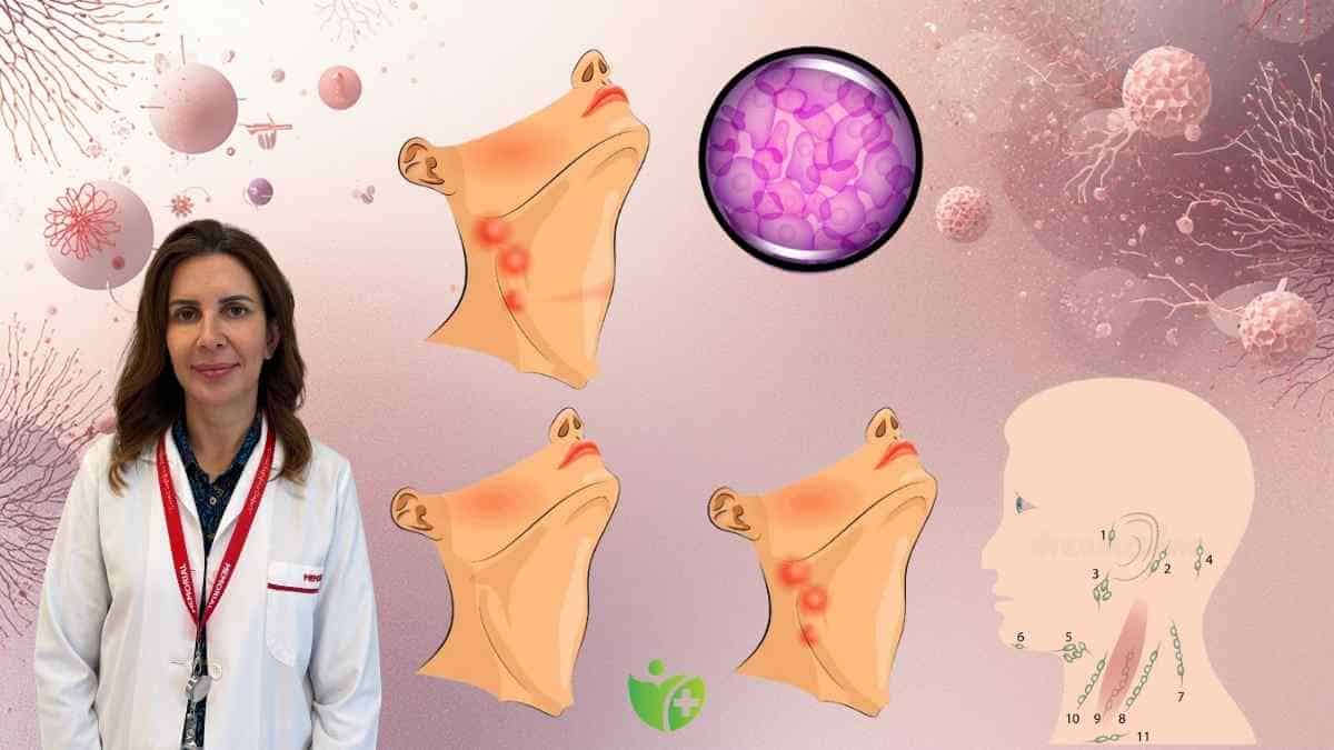 Lenfadenopati nedir? Çocuklarda Lenf bezi sişmesi ne zaman tehlikeli? 7