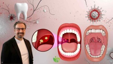 Geçmeyen Ağız kokusunun nedeni Bademcik taşları olabilir 3