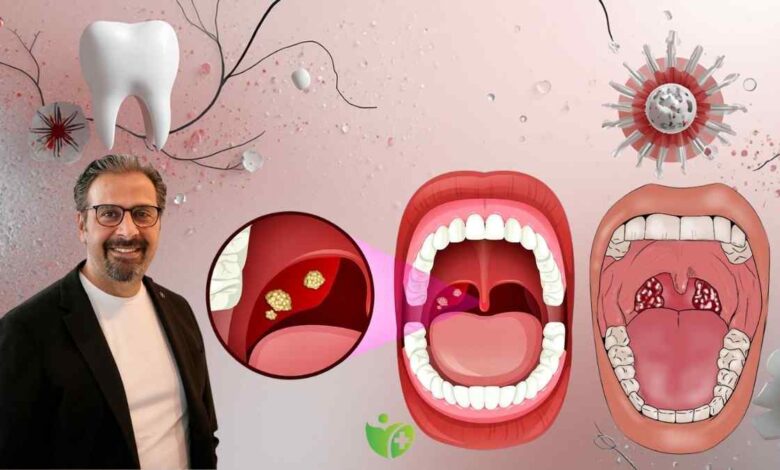 Geçmeyen Ağız kokusunun nedeni Bademcik taşları olabilir 1