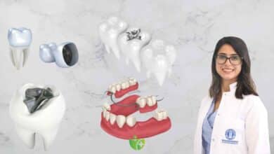 Diş hekimleri Amalgam dolgular için ne diyor? Sökülmeli mi, Kalmalı mı? 1