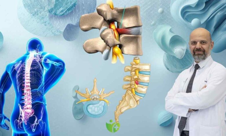 Bel Fıtığında erken Cerrahi ile hızlı iyileşme mümkün mü? 1