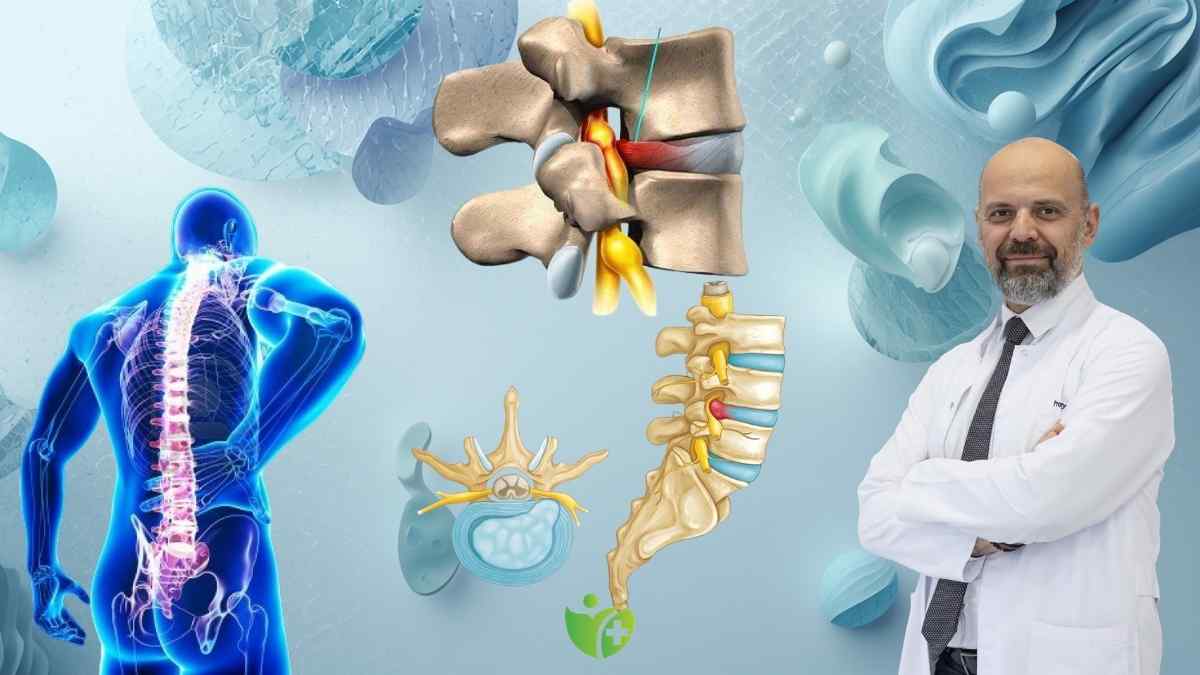 Bel Fıtığında erken Cerrahi ile hızlı iyileşme mümkün mü? 7