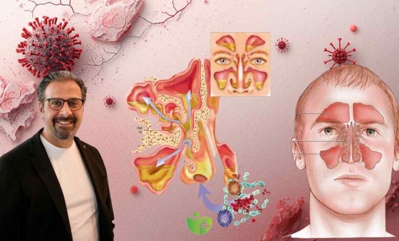 Baharın gelmesiyle Alerjik Burun tıkanıklığı arttı 1