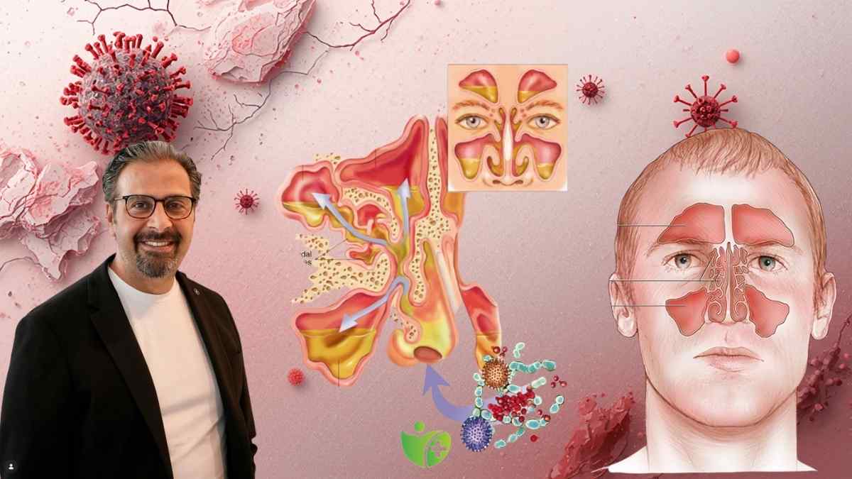 Baharın gelmesiyle Alerjik Burun tıkanıklığı arttı 7