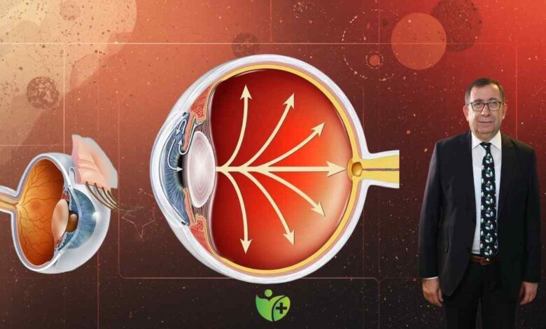 Göz Tansiyonu (Glokom) Körlüğe yol açmadan önlem alın 1