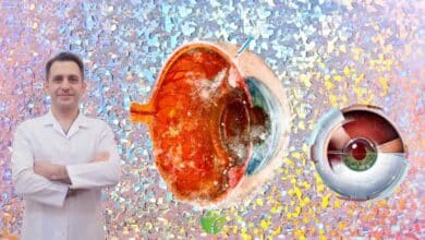 Yaşlanan gözler için yeni nesil çözüm: Trifokal akıllı mercek 2