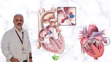 Kalp Kapak hastalıklarında Robotik Cerrahi dönemi 3