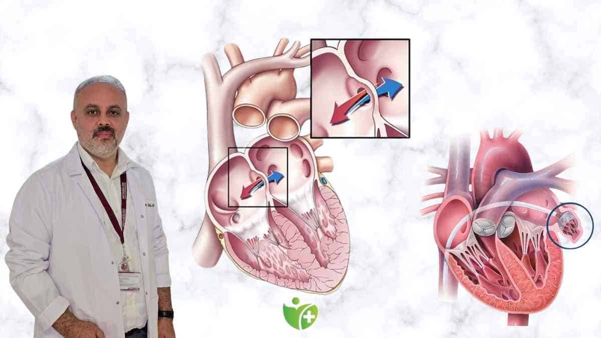 Kalp Kapak hastalıklarında Robotik Cerrahi dönemi 7