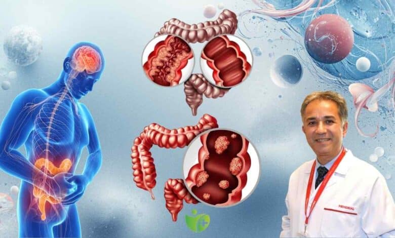 Kolon Kanserinden korunmak için bilmeniz gereken 7 risk faktörü 1