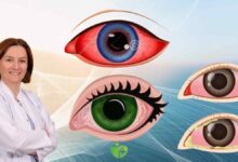 Gözlerinizi bekleyen Bahar tehlikeleri ve Korunma yolları 4