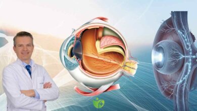 Pterjium (Göz Eti) neden olur? İşte 4 temel risk faktörü 3